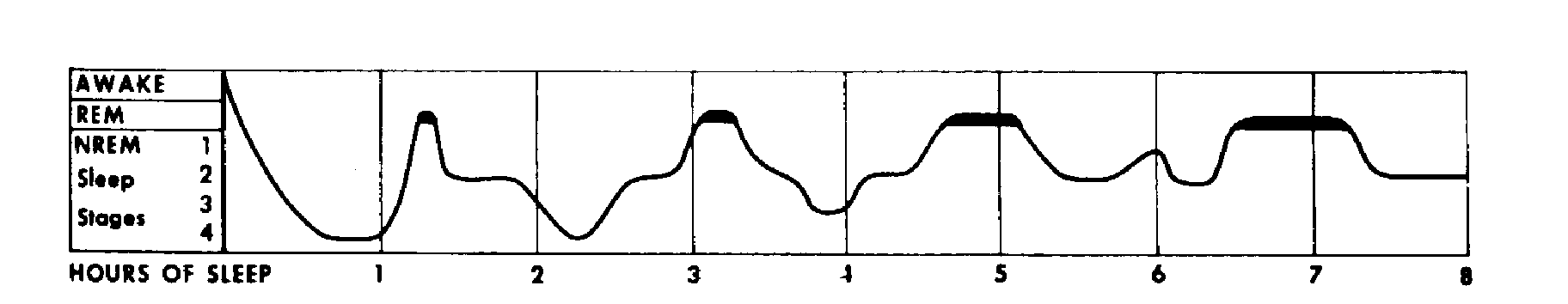 Schlafphasen Diagramm