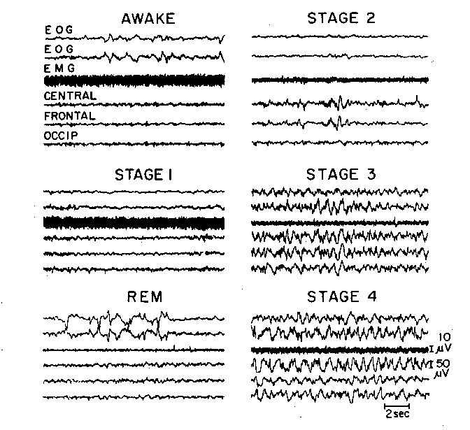 EEG curves